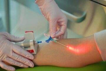 Terapia intravenoasa cu laser